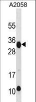 NKG2DL4 / ULBP4 Antibody - RAET1E Antibody western blot of A2058 cell line lysates (35 ug/lane). The RAET1E antibody detected the RAET1E protein (arrow).