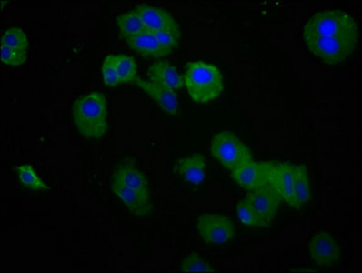 NKG2DL4 / ULBP4 Antibody - Immunofluorescence staining of HepG2 cells with RAET1E Antibody at 1:200, counter-stained with DAPI. The cells were fixed in 4% formaldehyde, permeabilized using 0.2% Triton X-100 and blocked in 10% normal Goat Serum. The cells were then incubated with the antibody overnight at 4°C. The secondary antibody was Alexa Fluor 488-congugated AffiniPure Goat Anti-Rabbit IgG(H+L).