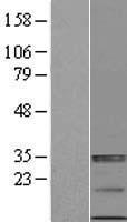 NKG2DL4 / ULBP4 Protein - Western validation with an anti-DDK antibody * L: Control HEK293 lysate R: Over-expression lysate