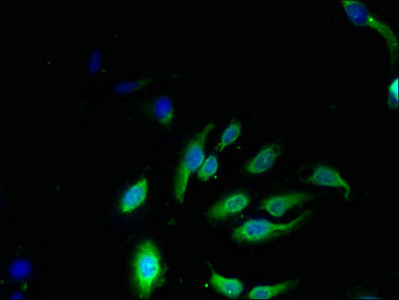 NKG7 / GMP-17 Antibody - Immunofluorescent analysis of Hela cells using NKG7 Antibody at dilution of 1:100 and Alexa Fluor 488-congugated AffiniPure Goat Anti-Rabbit IgG(H+L)