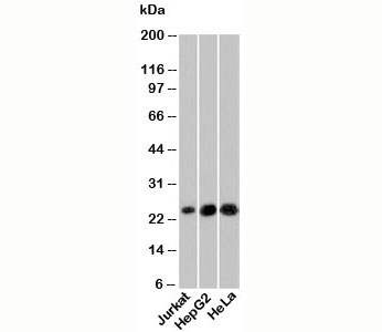 NKIRAS1 Antibody - NKIRAS1 antibody western blot of human samples