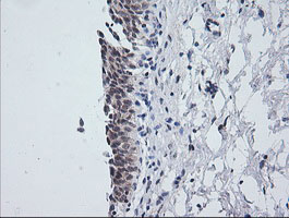 NKIRAS1 Antibody - IHC of paraffin-embedded Human bladder tissue using anti-NKIRAS1 mouse monoclonal antibody.