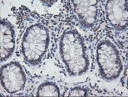 NKIRAS1 Antibody - IHC of paraffin-embedded Human colon tissue using anti-NKIRAS1 mouse monoclonal antibody.
