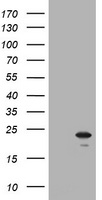 NKIRAS1 Antibody - HEK293T cells were transfected with the pCMV6-ENTRY control (Left lane) or pCMV6-ENTRY NKIRAS1 (Right lane) cDNA for 48 hrs and lysed. Equivalent amounts of cell lysates (5 ug per lane) were separated by SDS-PAGE and immunoblotted with anti-NKIRAS1.