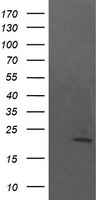 NKIRAS1 Antibody - HEK293T cells were transfected with the pCMV6-ENTRY control (Left lane) or pCMV6-ENTRY NKIRAS1 (Right lane) cDNA for 48 hrs and lysed. Equivalent amounts of cell lysates (5 ug per lane) were separated by SDS-PAGE and immunoblotted with anti-NKIRAS1.