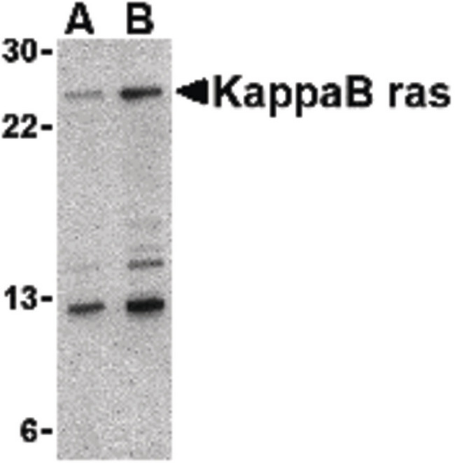 NKIRAS1 Antibody - Western blot of KappaB ras in 293 cell lysate with KappaB ras antibody at (A) 2 and (B) 4 ug/ml.