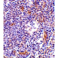 NKIRAS1 Antibody - Immunohistochemistry of KappaB ras in human lymph node tissue with KappaB ras antibody at 1 µg/mL.