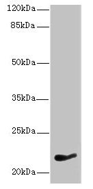 NKIRAS1 Antibody - Western blot All lanes: NKIRAS1 antibody at 7µg/ml + HepG2 whole cell lysate Secondary Goat polyclonal to rabbit IgG at 1/10000 dilution Predicted band size: 22 kDa Observed band size: 22 kDa