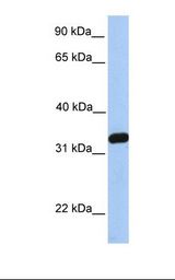 NKIRAS2 Antibody - 721_B cell lysate. Antibody concentration: 1.0 ug/ml. Gel concentration: 12%.  This image was taken for the unconjugated form of this product. Other forms have not been tested.