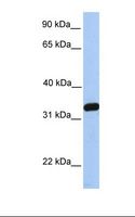 NKIRAS2 Antibody - 721_B cell lysate. Antibody concentration: 1.0 ug/ml. Gel concentration: 12%.  This image was taken for the unconjugated form of this product. Other forms have not been tested.