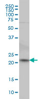 NKIRAS2 Antibody - NKIRAS2 monoclonal antibody (M02), clone 2G9 Western blot of NKIRAS2 expression in HeLa.