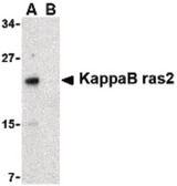 NKIRAS2 Antibody - Western blot of KappaB ras2 in RAW264.7 cell lysate with KappaB ras1 antibody at 1 ug/ml in the (A) absence and (B) presence of blocking peptide.