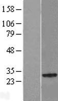 NKIRAS2 Protein - Western validation with an anti-DDK antibody * L: Control HEK293 lysate R: Over-expression lysate