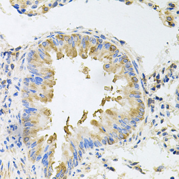 NKP30 Antibody - Immunohistochemistry of paraffin-embedded mouse lung tissue.