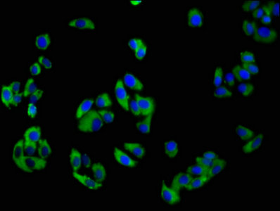 NKP30 Antibody - Immunofluorescence staining of HepG2 cells with NCR3 Antibody at 1:100, counter-stained with DAPI. The cells were fixed in 4% formaldehyde, permeabilized using 0.2% Triton X-100 and blocked in 10% normal Goat Serum. The cells were then incubated with the antibody overnight at 4°C. The secondary antibody was Alexa Fluor 488-congugated AffiniPure Goat Anti-Rabbit IgG(H+L).