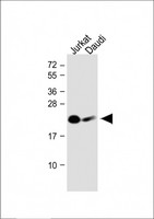 NKP30 Antibody - All lanes: Anti-NCR3 Antibody (N-Term) at 1:1000 dilution Lane 1: Jurkat whole cell lysate Lane 2: Daudi whole cell lysate Lysates/proteins at 20 µg per lane. Secondary Goat Anti-Rabbit IgG, (H+L), Peroxidase conjugated at 1/10000 dilution. Predicted band size: 22 kDa Blocking/Dilution buffer: 5% NFDM/TBST.