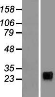 NKP30 Protein - Western validation with an anti-DDK antibody * L: Control HEK293 lysate R: Over-expression lysate