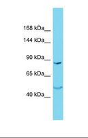 NKPD1 Antibody - Western blot of Jurkat. NSMCE4A antibody dilution 1.0 ug/ml.  This image was taken for the unconjugated form of this product. Other forms have not been tested.
