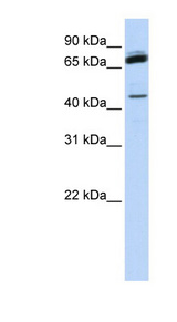 NKRF / NRF Antibody - NKRF antibody Western blot of Fetal Muscle lysate. This image was taken for the unconjugated form of this product. Other forms have not been tested.