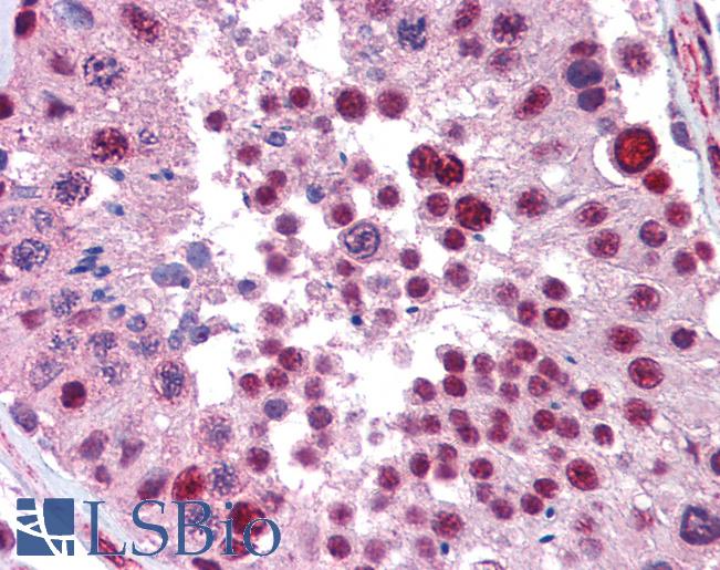 NKRF / NRF Antibody - Anti-NKRF antibody IHC of human testis. Immunohistochemistry of formalin-fixed, paraffin-embedded tissue after heat-induced antigen retrieval. Antibody concentration 5 ug/ml.  This image was taken for the unconjugated form of this product. Other forms have not been tested.