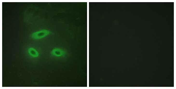 NKTR Antibody - Immunofluorescence analysis of HeLa cells, using NKTR Antibody. The picture on the right is blocked with the synthesized peptide.