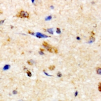 NKTR Antibody - Immunohistochemical analysis of NKTR staining in human brain formalin fixed paraffin embedded tissue section. The section was pre-treated using heat mediated antigen retrieval with sodium citrate buffer (pH 6.0). The section was then incubated with the antibody at room temperature and detected using an HRP conjugated compact polymer system. DAB was used as the chromogen. The section was then counterstained with haematoxylin and mounted with DPX.
