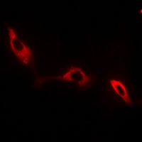 NKTR Antibody - Immunofluorescent analysis of NKTR staining in HeLa cells. Formalin-fixed cells were permeabilized with 0.1% Triton X-100 in TBS for 5-10 minutes and blocked with 3% BSA-PBS for 30 minutes at room temperature. Cells were probed with the primary antibody in 3% BSA-PBS and incubated overnight at 4 °C in a hidified chamber. Cells were washed with PBST and incubated with Alexa Fluor 647-conjugated secondary antibody (red) in PBS at room temperature in the dark.