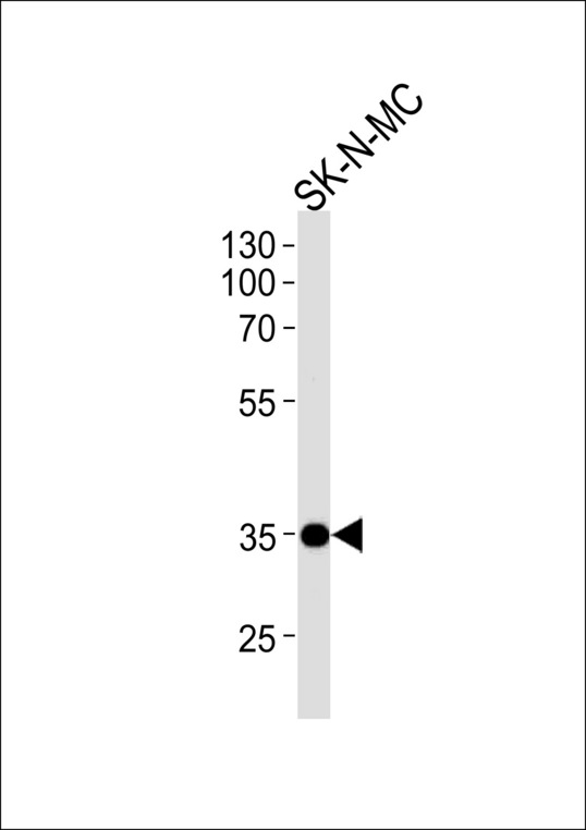 NKX1-1 Antibody - NKX1-1 Antibody western blot of SK-N-MC cell line lysates (35 ug/lane). The NKX1-1 antibody detected the NKX1-1 protein (arrow).