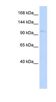 NKX1-1 Antibody - NKX1-1 antibody Western blot of Fetal Lung lysate. This image was taken for the unconjugated form of this product. Other forms have not been tested.