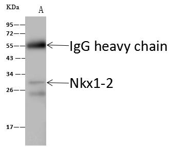 NKX1-2 Antibody - TXN2 was immunoprecipitated using: Lane A: 0.5 mg HeLa Whole Cell Lysate. 4 uL anti-TXN2 rabbit polyclonal antibody and 60 ug of Immunomagnetic beads Protein A/G. Primary antibody: Anti-TXN2 rabbit polyclonal antibody, at 1:100 dilution. Secondary antibody: Goat Anti-Rabbit IgG (H+L)/HRP at 1/10000 dilution. Developed using the ECL technique. Performed under reducing conditions. Predicted band size: 18 kDa. Observed band size: 13 kDa.