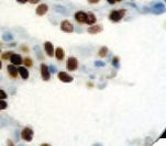 NKX2-1 / Thyroid-Specific TF Antibody - IHC of TTF-1 on FFPE Lung tissue. This image was taken for the unmodified form of this product. Other forms have not been tested.