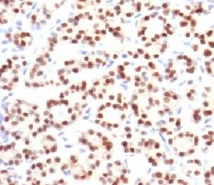 NKX2-1 / Thyroid-Specific TF Antibody - IHC testing of FFPE human thyroid tissue with TTF1 antibody (clone HBNK2-1).  This image was taken for the unmodified form of this product. Other forms have not been tested.