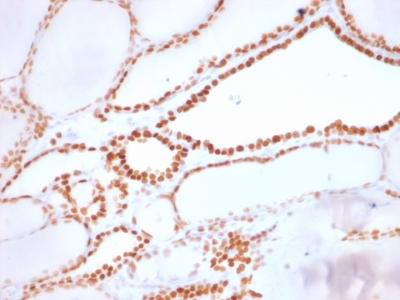 NKX2-1 / Thyroid-Specific TF Antibody - Formalin-fixed, paraffin-embedded human Thyroid stained with TTF-1 Rabbit Recombinant Monoclonal Antibody (NX2.1/1855R).