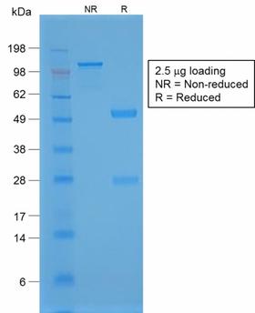 NKX2-1 / Thyroid-Specific TF Antibody - SDS-PAGE Analysis Purified TTF-1 Rabbit Recombinant Monoclonal Antibody (NX2.1/1855R). Confirmation of Purity and Integrity of Antibody.