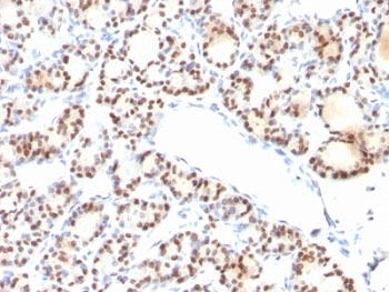 NKX2-1 / Thyroid-Specific TF Antibody - Formalin-fixed, paraffin-embedded human thyroid stained with TTF1 antibody (NX2.1/690).  This image was taken for the unmodified form of this product. Other forms have not been tested.