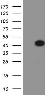 NKX2-1 / Thyroid-Specific TF Antibody - HEK293T cells were transfected with the pCMV6-ENTRY control (Left lane) or pCMV6-ENTRY NKX2-1 (Right lane) cDNA for 48 hrs and lysed. Equivalent amounts of cell lysates (5 ug per lane) were separated by SDS-PAGE and immunoblotted with anti-NKX2-1.