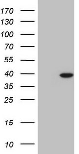 NKX2-1 / Thyroid-Specific TF Antibody - HEK293T cells were transfected with the pCMV6-ENTRY control (Left lane) or pCMV6-ENTRY NKX2-1 (Right lane) cDNA for 48 hrs and lysed. Equivalent amounts of cell lysates (5 ug per lane) were separated by SDS-PAGE and immunoblotted with anti-NKX2-1.