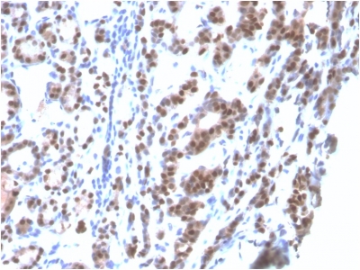 NKX2-1 / Thyroid-Specific TF Antibody - Formalin-fixed, paraffin-embedded human Thyroidstained with TTF-1 Mouse Recombinant Monoclonal Antibody (rNX2.1/690).