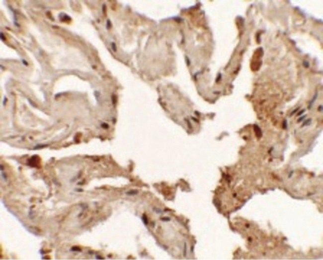 NKX2-1 / Thyroid-Specific TF Antibody - Immunohistochemistry of NKX2-1 in human lung tissue with NKX2-1 antibody at 2.5 ug/ml.