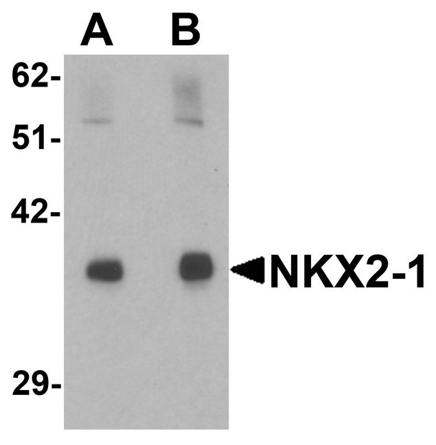 NKX2-1 / Thyroid-Specific TF Antibody - Western blot analysis of NKX2-1 in rat lung tissue lysate with NKX2-1 antibody at (A) 1 and (B) 2 ug/ml.
