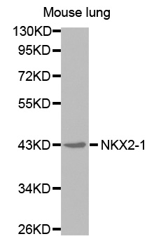 NKX2-1 / Thyroid-Specific TF Antibody - Western blot analysis of extracts of mouse lung cell line, using NKX2-1 antibody.