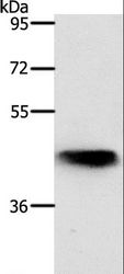 NKX2-1 / Thyroid-Specific TF Antibody - Western blot analysis of Mouse lung tissue, using NKX2-1 Polyclonal Antibody at dilution of 1:700.