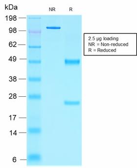 NKX2-2 Antibody - SDS-PAGE Analysis Purified NKX2.2 Mouse Recombinant Monoclonal Antibody (rNX2/1523). Confirmation of Purity and Integrity of Antibody.