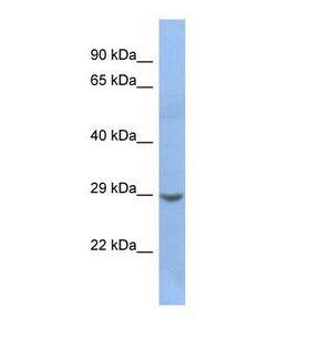 NKX2-2 Antibody - Western blot of Human Jurkat. NKX2-2 antibody dilution 1.0 ug/ml.  This image was taken for the unconjugated form of this product. Other forms have not been tested.