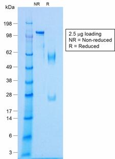 NKX2-2 Antibody - SDS-PAGE Analysis Purified NKX2.2 Rabbit Recombinant Monoclonal Antibody (NX2/1422R). Confirmation of Purity and Integrity of Antibody.