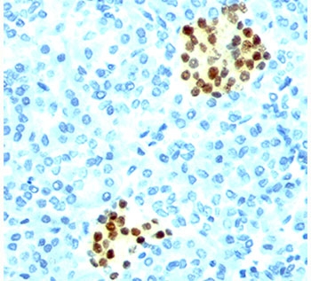NKX2-2 Antibody - NKX2.2 antibody NX2/294 immunohistochemistry pancreas.  This image was taken for the unmodified form of this product. Other forms have not been tested.