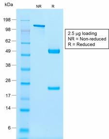 NKX2-2 Antibody - SDS-PAGE Analysis Purified NKX2.2 Mouse Recombinant Monoclonal Antibody (rNX2/294). Confirmation of Purity and Integrity of Antibody.