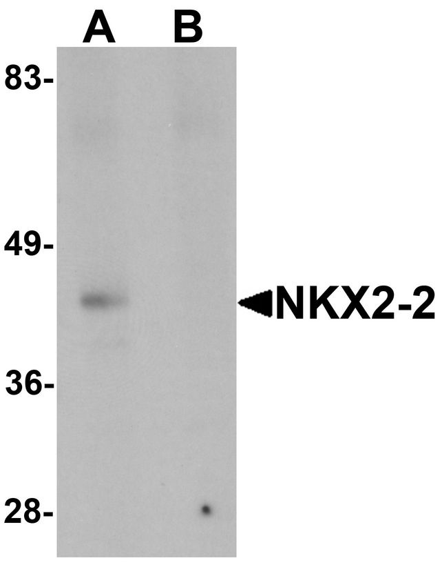 NKX2-2 Antibody - Western blot analysis of NKX2-2 in rat kidney tissue lysate with NKX2-2 antibody at 1 ug/ml in (A) the absence and (B) the presence of blocking peptide.