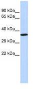 NKX2-2 Antibody - Western blot of placenta lysate.  This image was taken for the unconjugated form of this product. Other forms have not been tested.