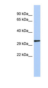 NKX2-2 Antibody - NKX2-2 antibody Western blot of Fetal Spleen lysate. This image was taken for the unconjugated form of this product. Other forms have not been tested.